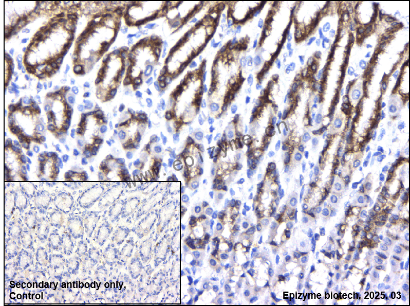 Anti-FDFT1 Rabbit mAb [20L04L51]