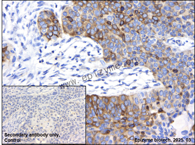 Anti-FDFT1 Rabbit mAb [20L04L51]