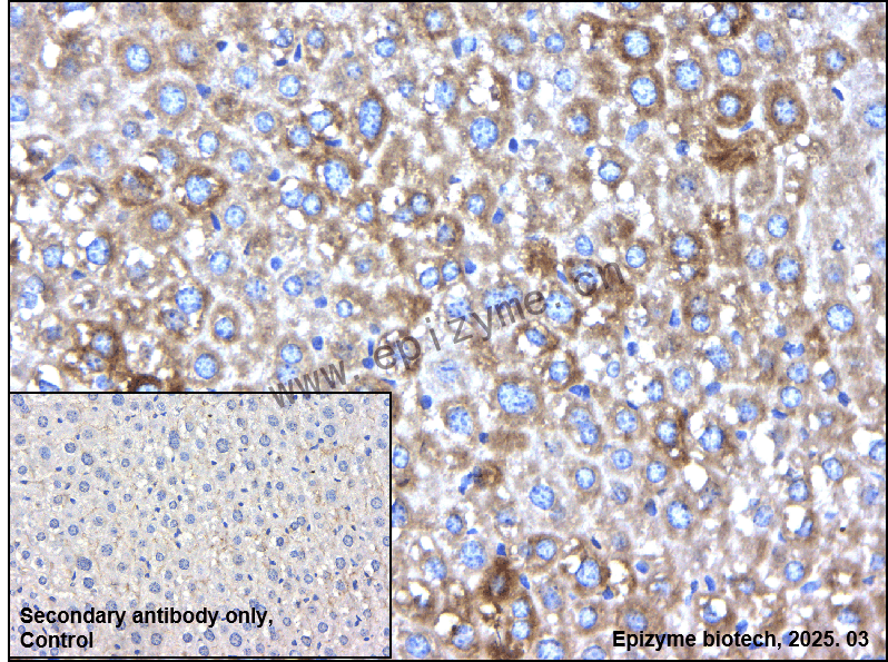 Anti-FDFT1 Rabbit mAb [20L04L51]