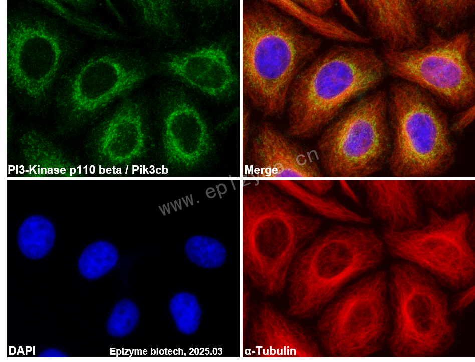 Anti-PI3-Kinase p110 beta Rabbit mAb [20K70M69]