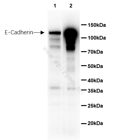 Anti-E Cadherin Rabbit mAb [10M94M96]