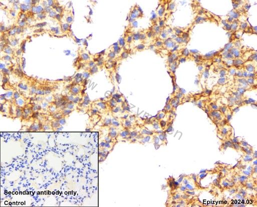 Anti-E Cadherin Rabbit mAb [10M94M96]