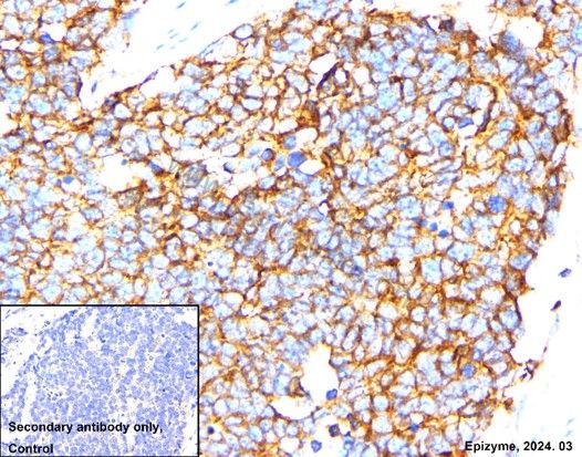 Anti-E Cadherin Rabbit mAb [10M94M96]