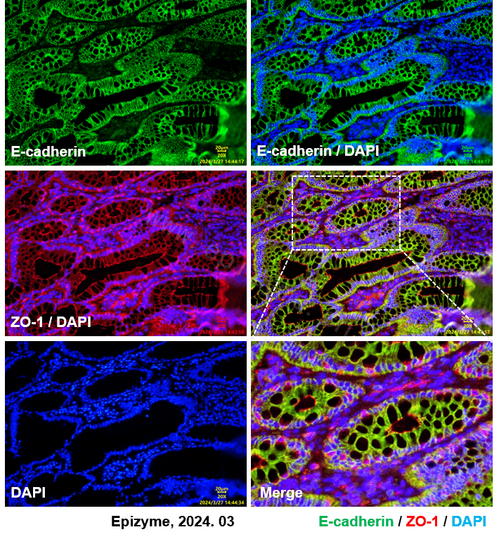 Anti-E Cadherin Rabbit mAb [10M94M96]