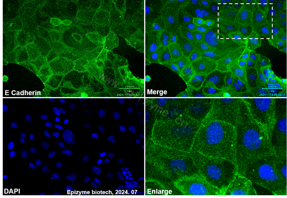 Anti-E Cadherin Rabbit mAb [10M94M96]