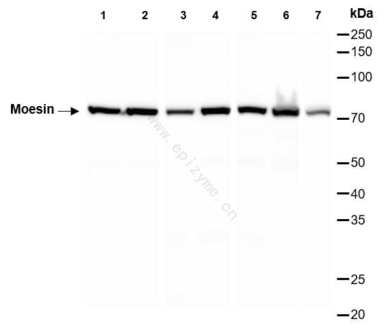 Anti-Moesin Rabbit mAb [26M83L82]