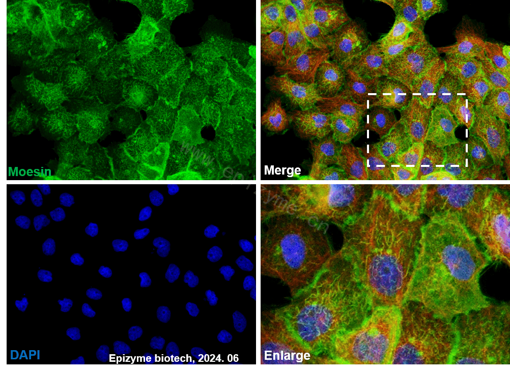 Anti-Moesin Rabbit mAb [26M83L82]