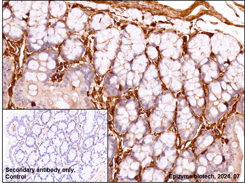 Anti-Moesin Rabbit mAb [26M83L82]