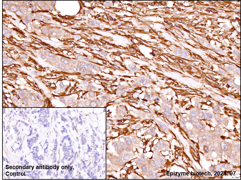 Anti-Moesin Rabbit mAb [26M83L82]