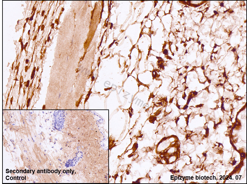 Anti-Moesin Rabbit mAb [26M83L82]