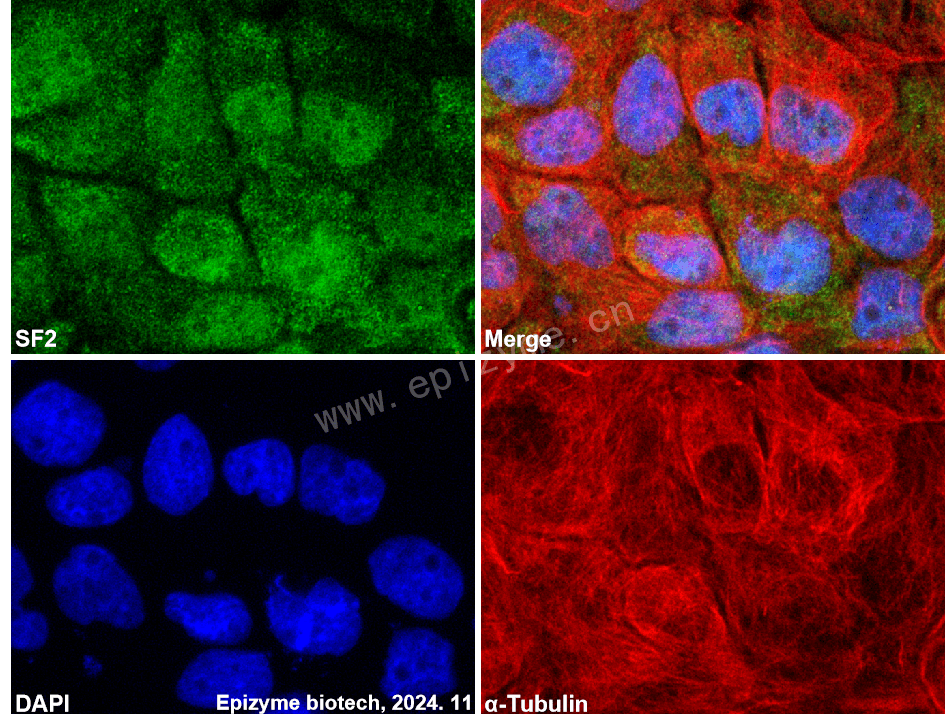 Anti-SF2 Rabbit mAb [52M36M95]