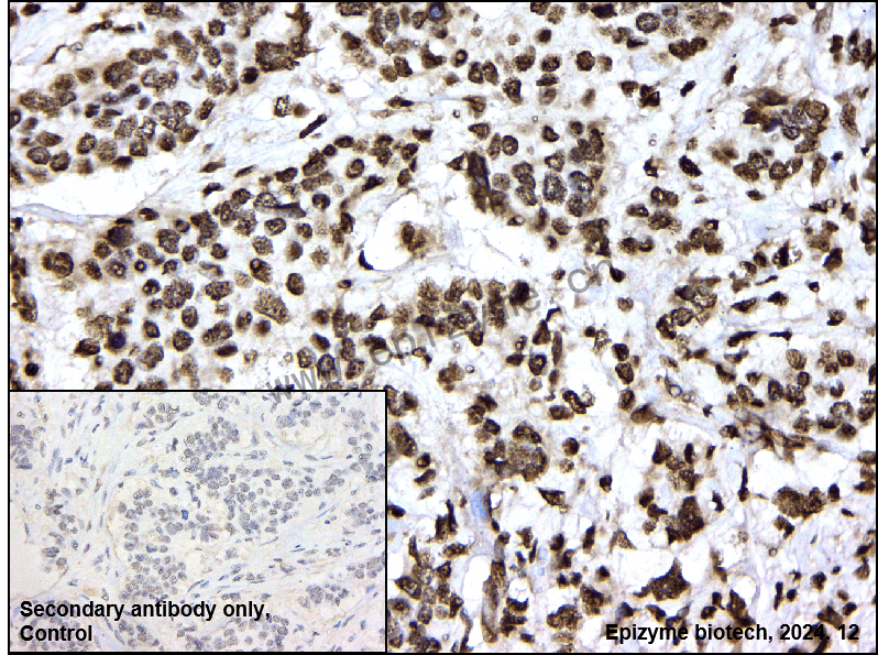 Anti-SF2 Rabbit mAb [52M36M95]