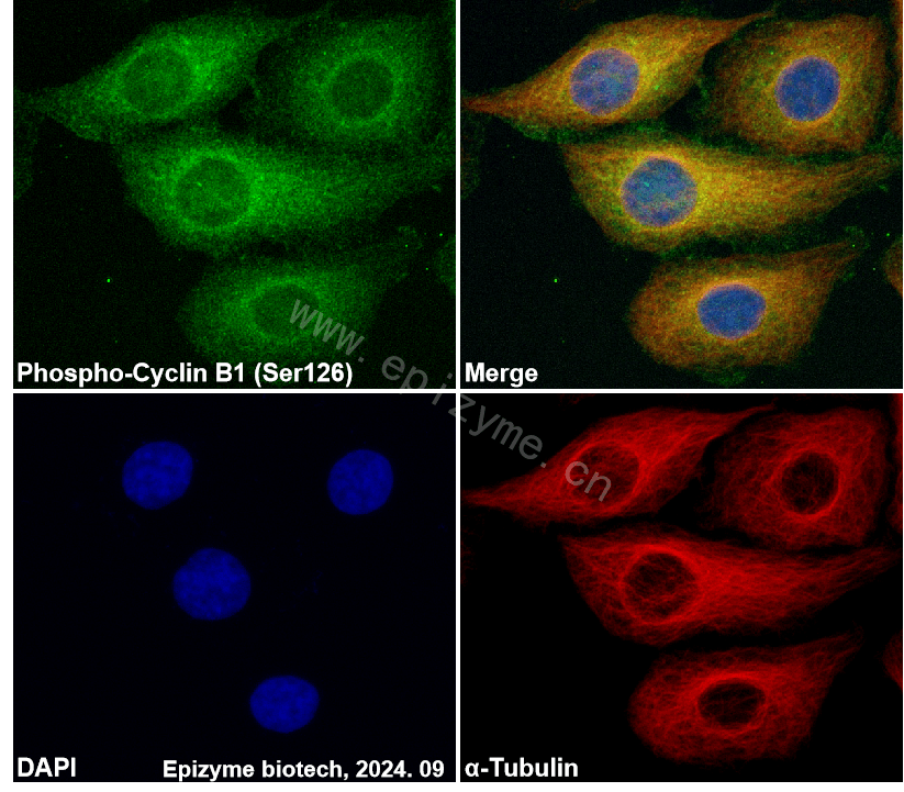 Anti-Phospho-Cyclin B1 (Ser126) Rabbit mAb [58L51K88]