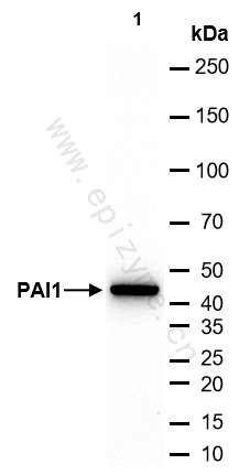 Anti-PAI1 Rabbit mAb [73L22K73]