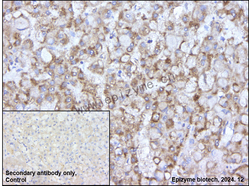 Anti-PAI1 Rabbit mAb [73L22K73]