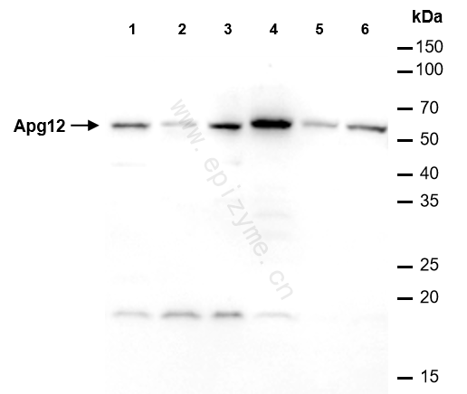 Anti-ATG12 Rabbit mAb [20L29M13]