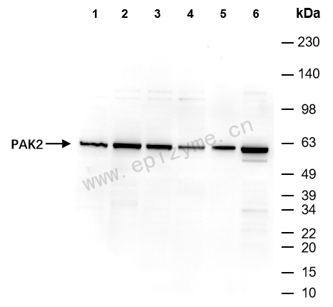 Anti-PAK2 Rabbit mAb [65L01M09]