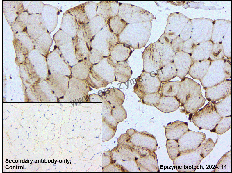 Anti-PAK2 Rabbit mAb [65L01M09]