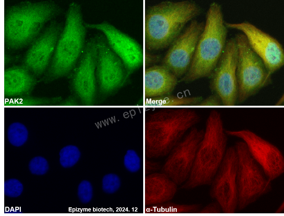 Anti-PAK2 Rabbit mAb [65L01M09]