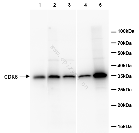 Anti-CDK6 Rabbit mAb [83K54M88]