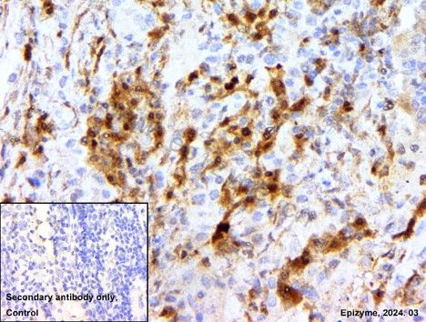 Anti-CDK6 Rabbit mAb [83K54M88]