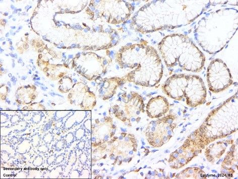 Anti-CDK6 Rabbit mAb [83K54M88]