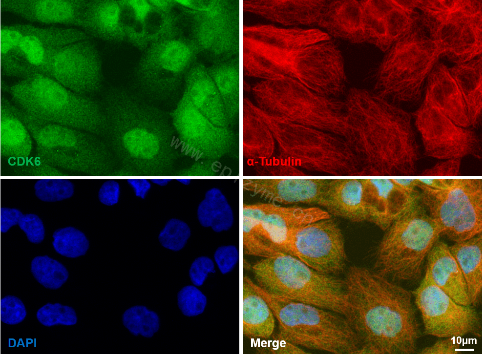 Anti-CDK6 Rabbit mAb [83K54M88]