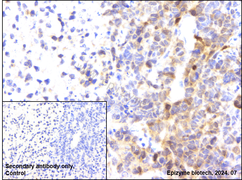 Anti-CDK6 Rabbit mAb [83K54M88]