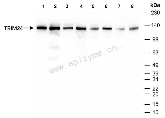 Anti-TRIM24 Rabbit mAb [44M94M33]