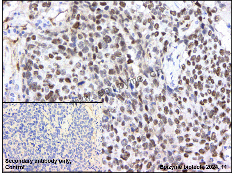 Anti-TRIM24 Rabbit mAb [44M94M33]