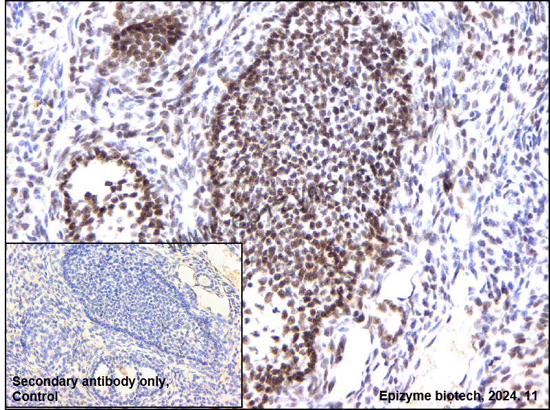 Anti-TRIM24 Rabbit mAb [44M94M33]