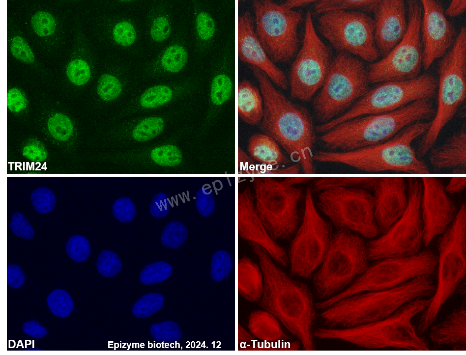 Anti-TRIM24 Rabbit mAb [44M94M33]