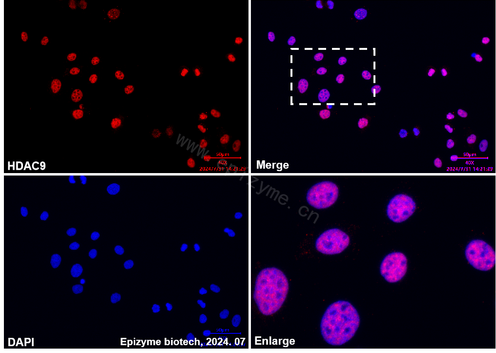 Anti-HDAC9 Rabbit mAb [11L76L09]