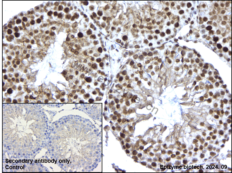 Anti-HDAC9 Rabbit mAb [11L76L09]