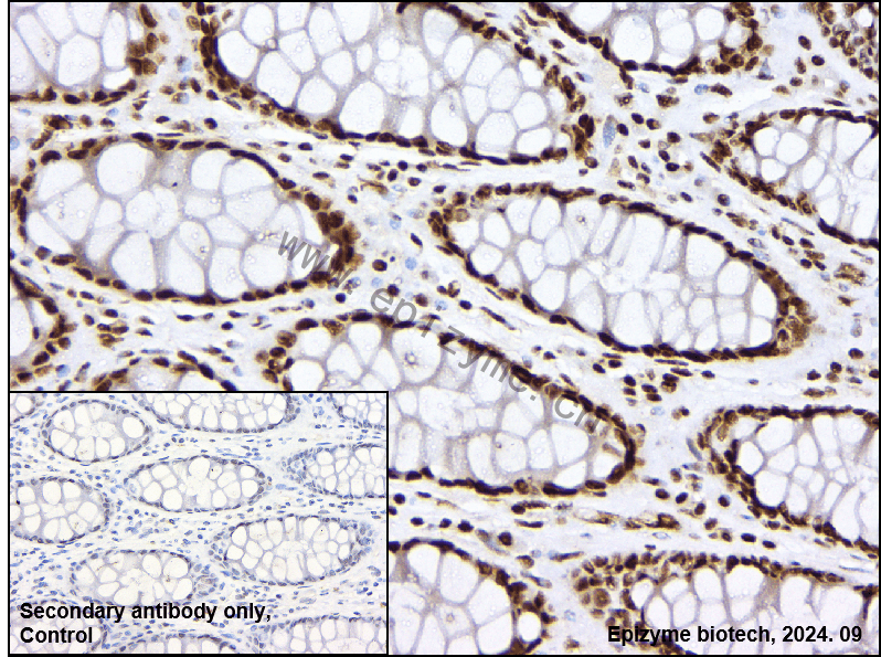 Anti-HDAC9 Rabbit mAb [11L76L09]