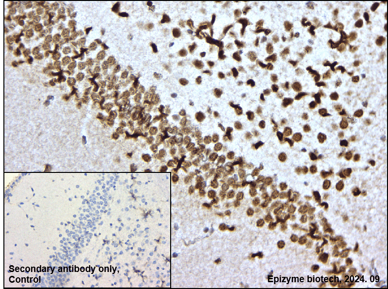 Anti-HDAC9 Rabbit mAb [11L76L09]