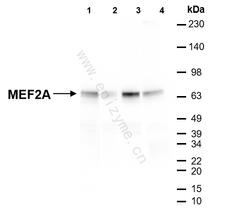 Anti-MEF2A Rabbit mAb [84L74M32]