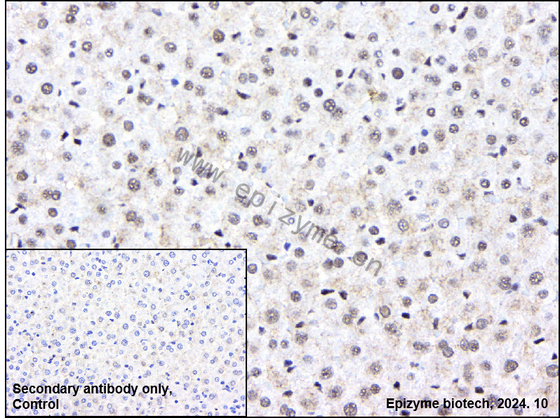 Anti-MEF2A Rabbit mAb [84L74M32]