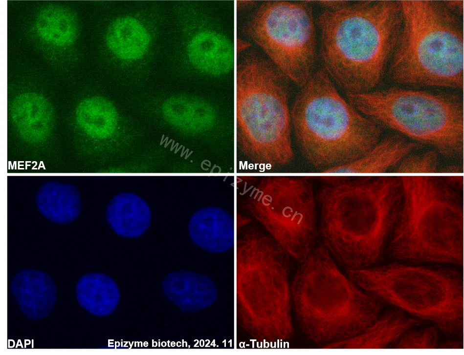 Anti-MEF2A Rabbit mAb [84L74M32]