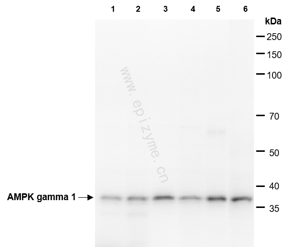 Anti-AMPK gamma 1 Rabbit mAb [56L11K81]