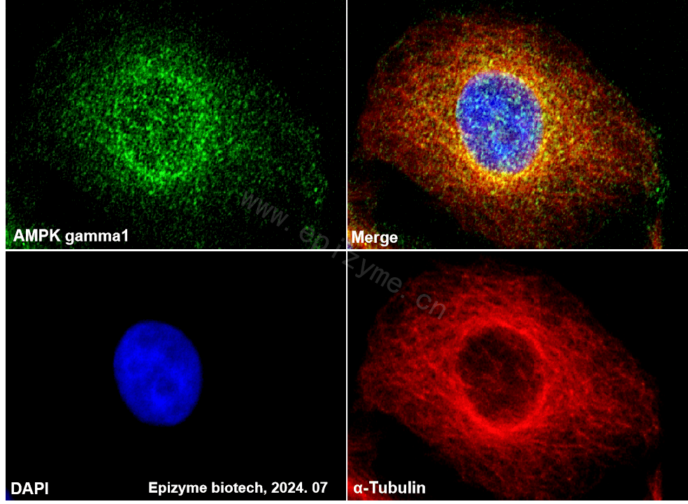 Anti-AMPK gamma 1 Rabbit mAb [56L11K81]