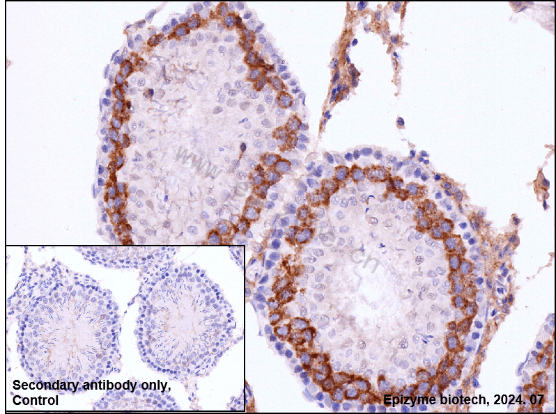 Anti-AMPK gamma 1 Rabbit mAb [56L11K81]