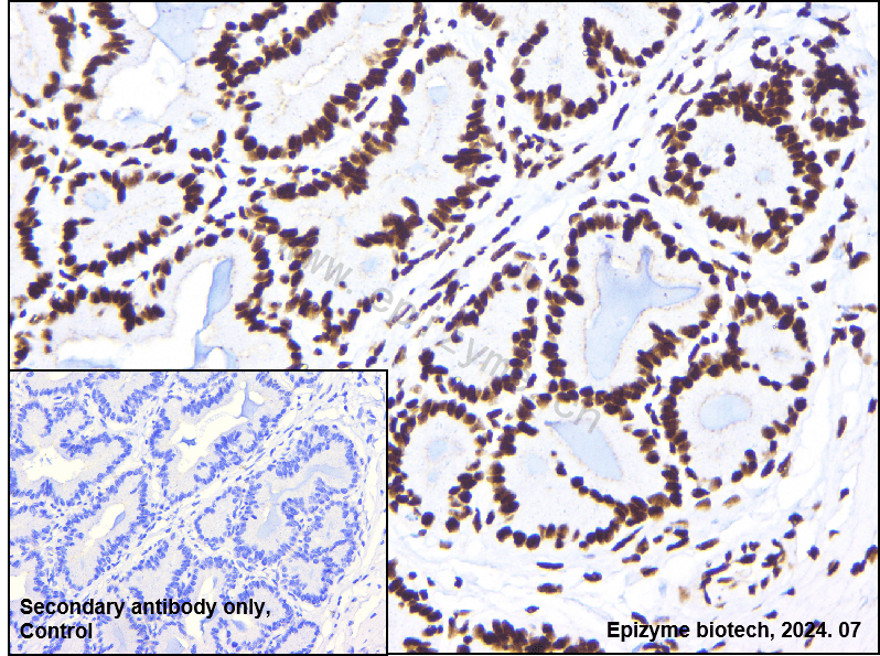 Anti-nmt55/p54nrb Rabbit mAb [98M11M21]