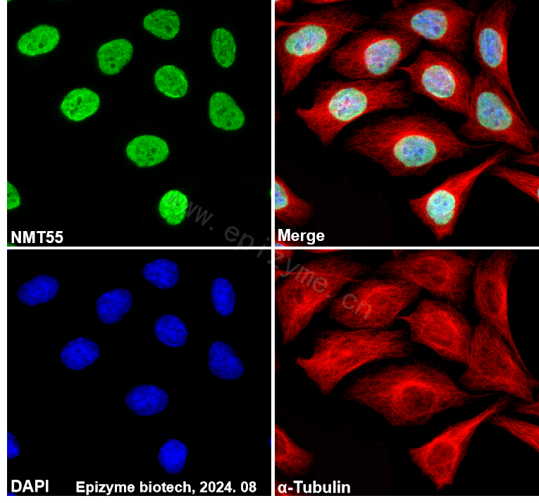 Anti-nmt55/p54nrb Rabbit mAb [98M11M21]
