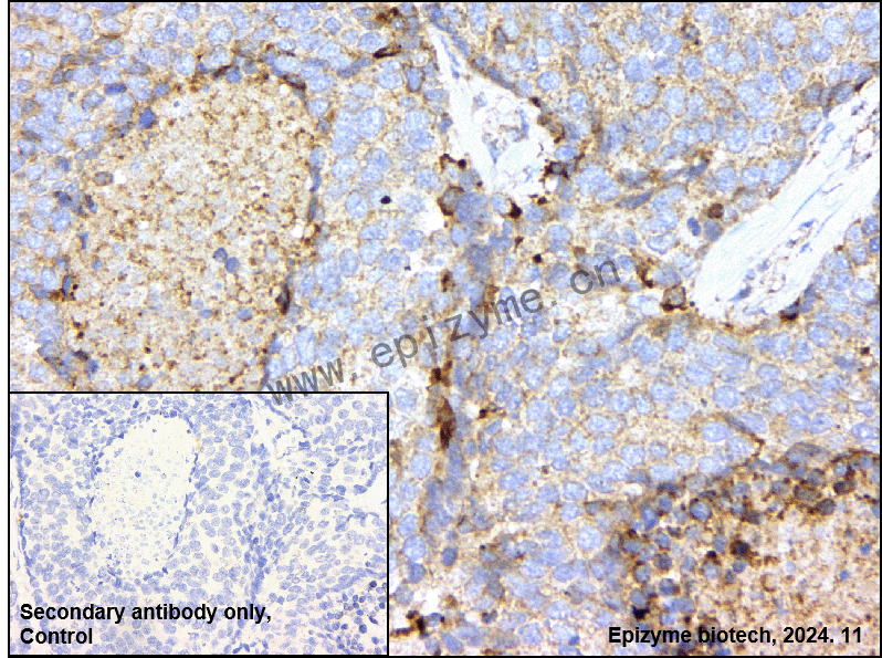 Anti-JAK2 Rabbit mAb [32M03M85]