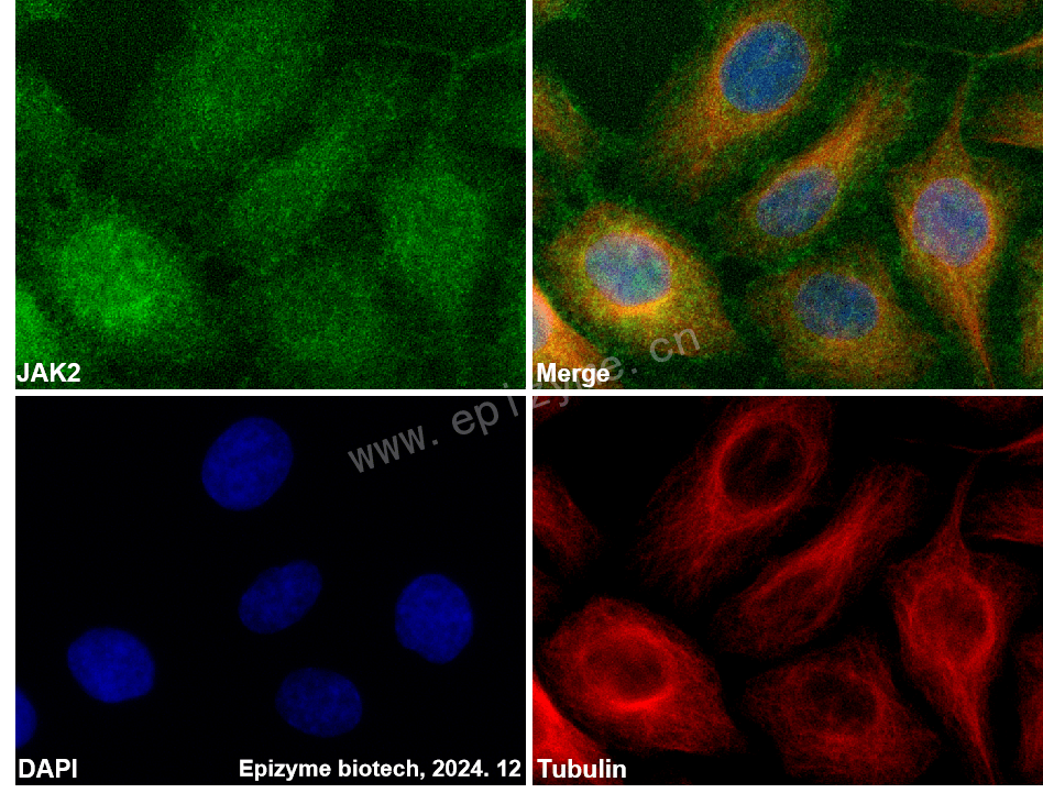 Anti-JAK2 Rabbit mAb [32M03M85]