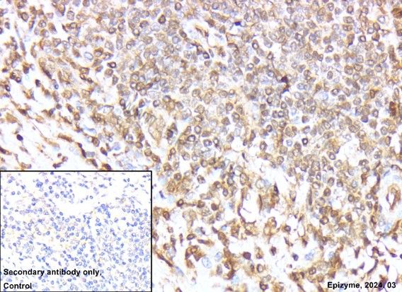 Anti-ERK1/2 Rabbit mAb [13M15K92]