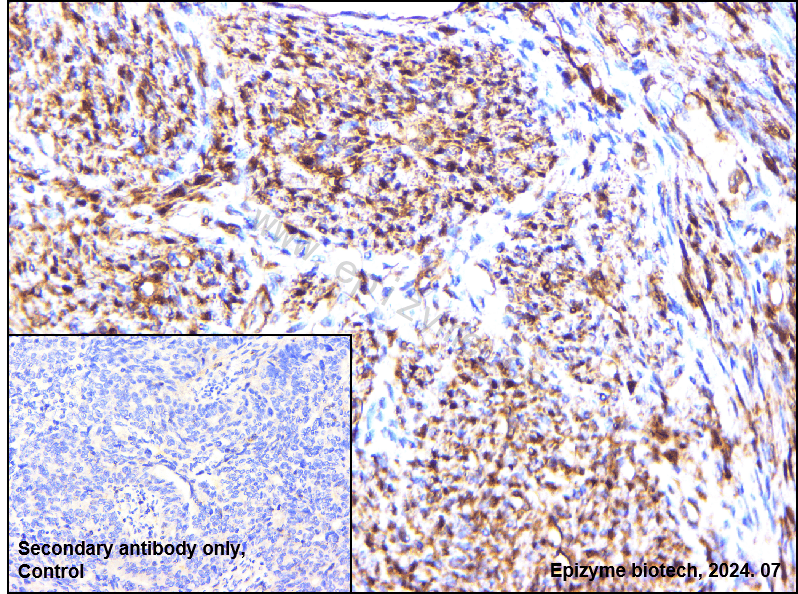 Anti-CAB39 Rabbit mAb [43M62M97]