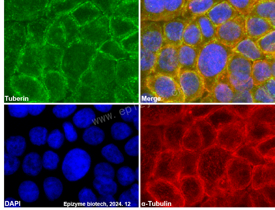 Anti-Tuberin Rabbit mAb [70M18M92]