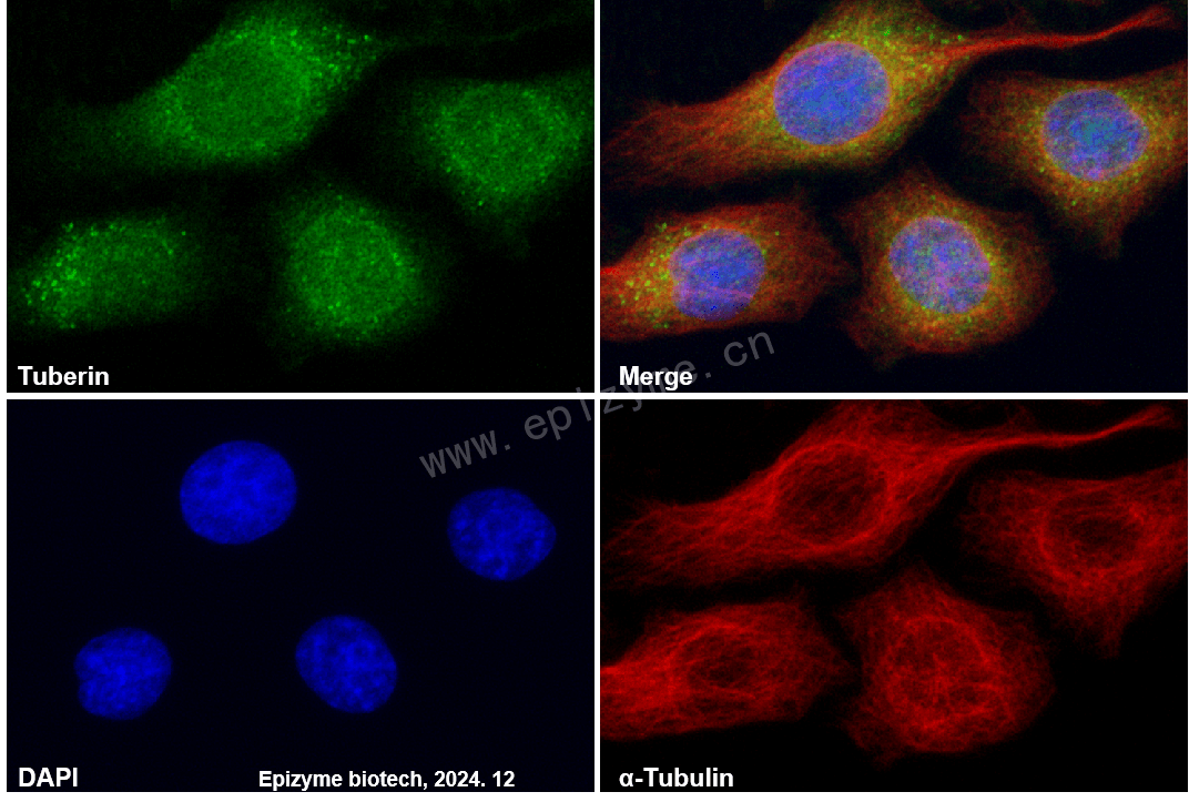 Anti-Tuberin Rabbit mAb [70M18M92]